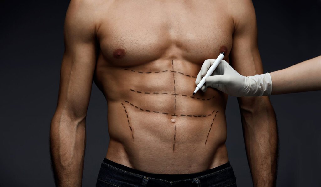 karın kasları çatlakları