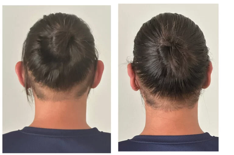 Before and after comparison of a person's hair from the back, showing the results of a hair treatment or styling procedure.