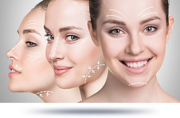 A collage of a woman's face from different angles, highlighting areas for facial rejuvenation with markings.
