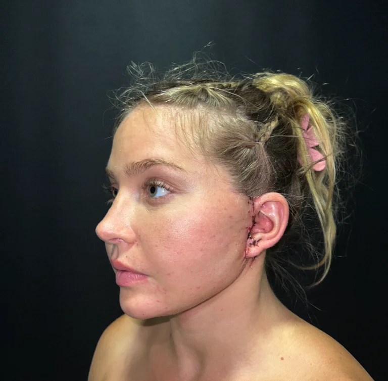 A young individual with blonde hair styled in a messy bun, looking to the side with a slight smile. The person has fair skin and is shown from the side, with their hair pinned back to reveal their ear and neck. The background is dark, which contrasts with the person's skin and hair, making them the focal point of the image.