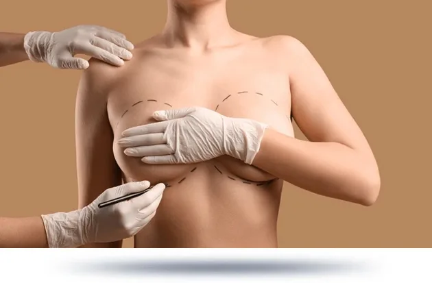 A surgeon marking the chest area of a patient in preparation for a breast augmentation procedure.