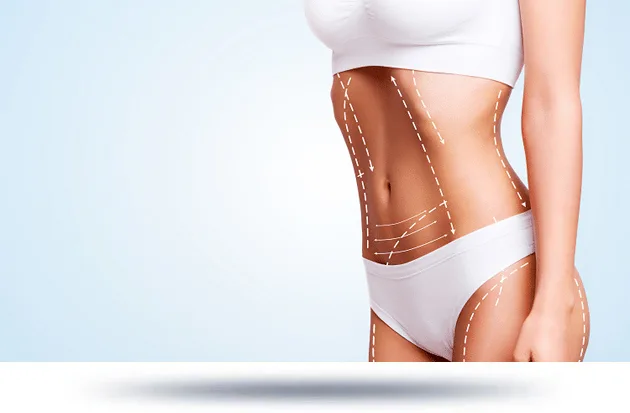 An illustration of a woman's torso highlighting areas for a mommy makeover procedure, including the abdomen and breasts, with dashed lines indicating the surgical areas.