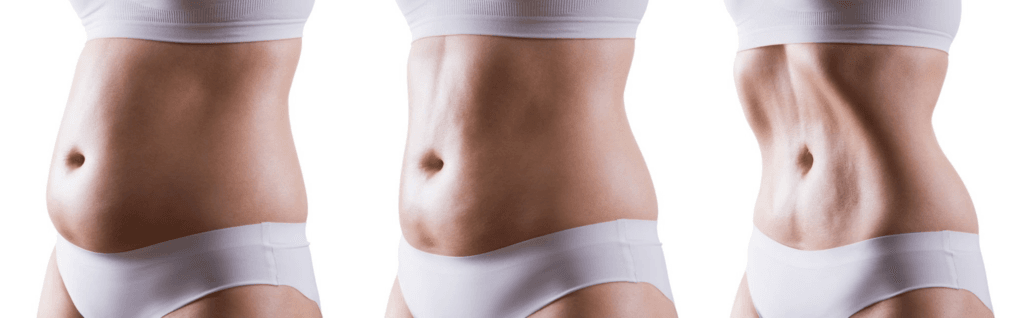 Mommy Makeover in Antalya: Rejuvenate and Revitalize Your Appearance! 1