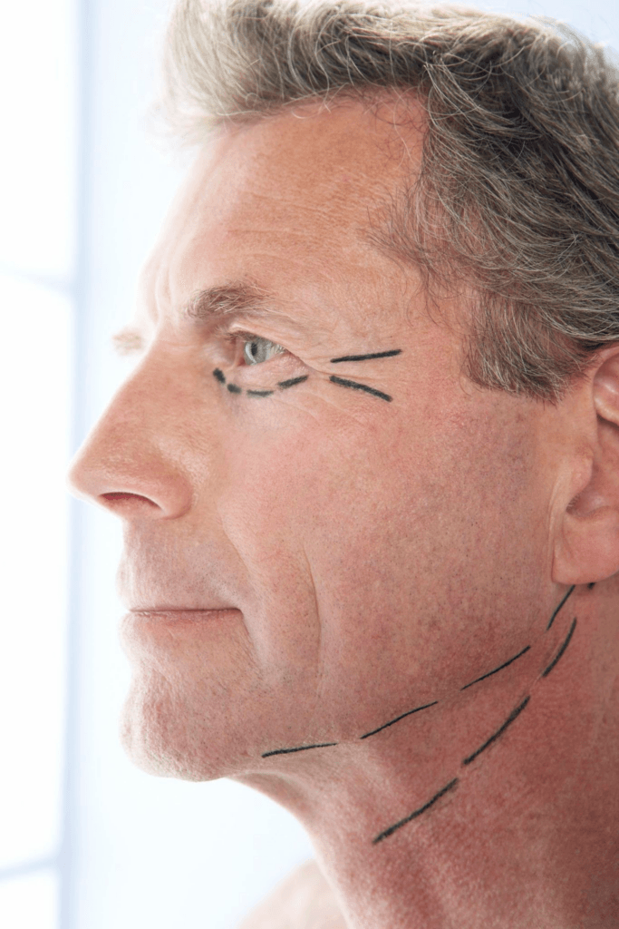 Ritidectomía: la solución definitiva para una piel joven. ¡Descúbrela ahora!