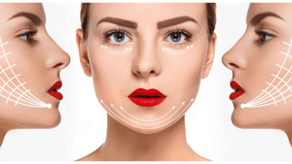 Что такое подтяжка лица за 1 час? 1