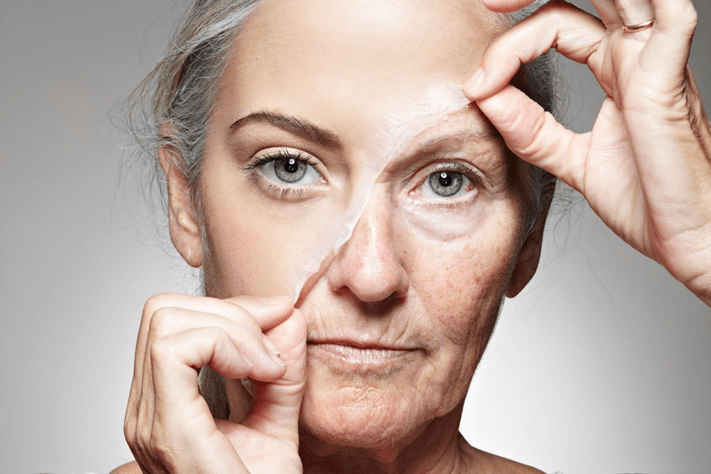 ¿A qué edad es demasiado tarde para un lifting facial? 1