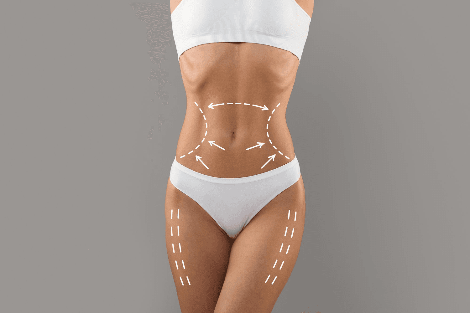 An illustration of a woman's abdomen and lower body with indicated areas for liposuction, highlighted by dashed lines around the waist, hips, and thighs.