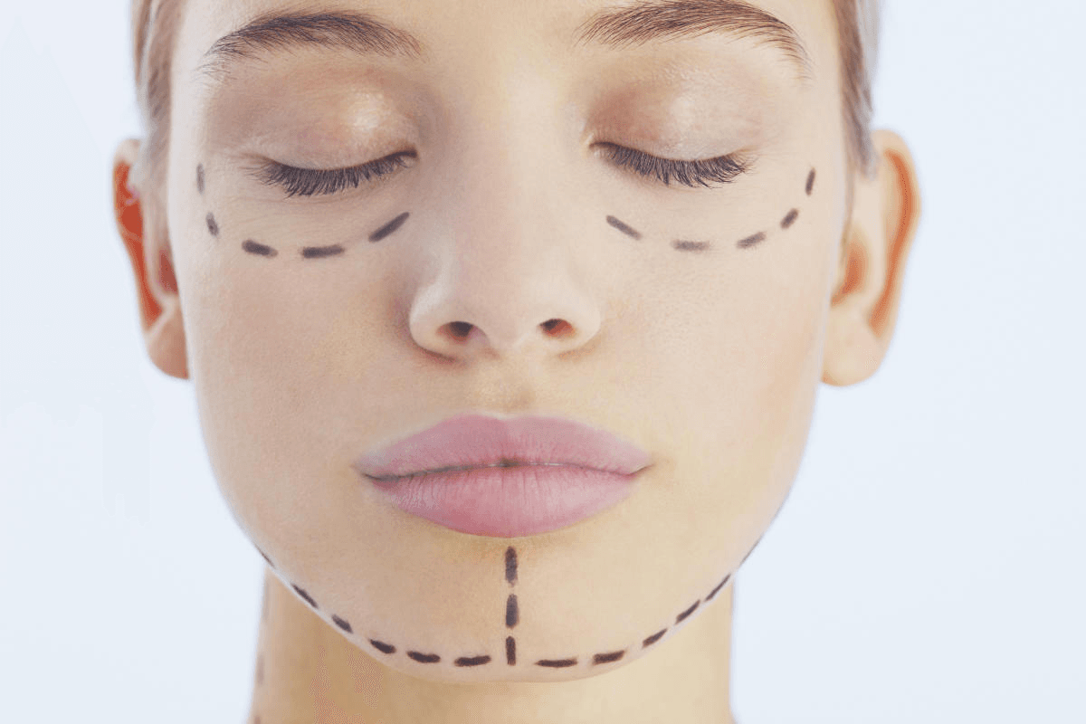 Welches ist das kostengünstigste Facelift?