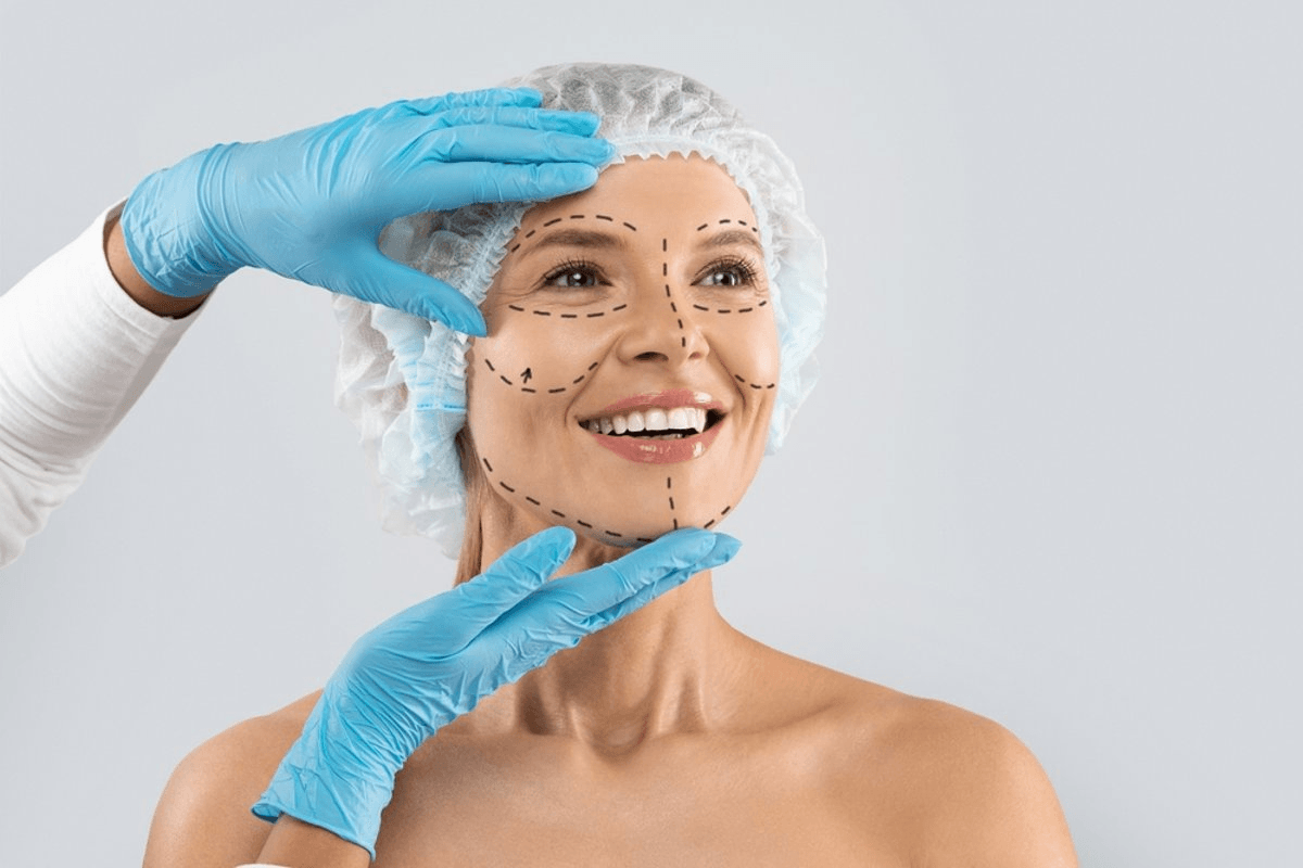 How long does a facelift last in the UK?