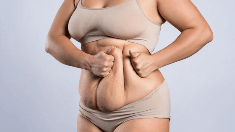 A person standing with their hands on their hips, showing signs of discomfort or pain in their lower back or abdomen.