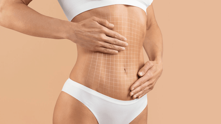 A person in white undergarments with a grid overlay on their abdomen, likely demonstrating a medical or aesthetic treatment area.