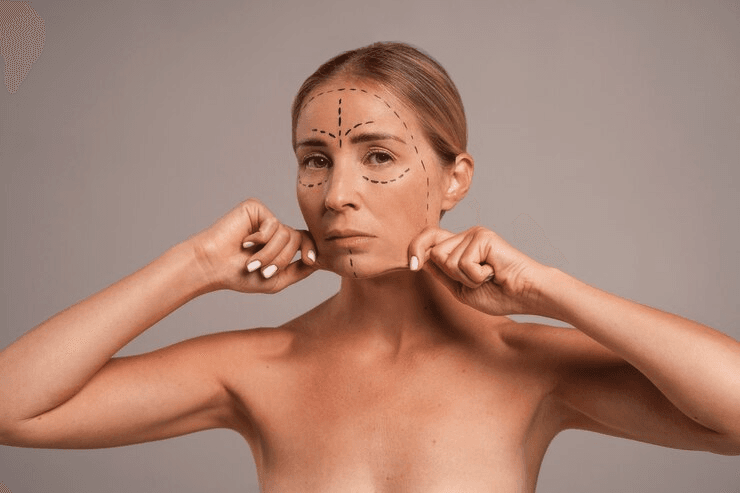 Face Lift Surgery in Turkey: Reviews and Insights 1