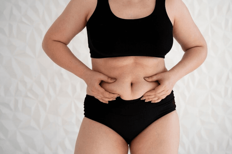 What is the best procedure to remove belly fat? 2