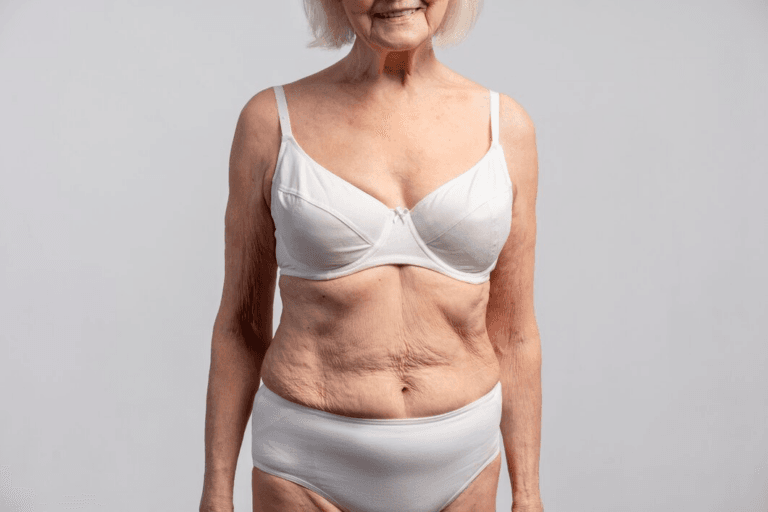 An elderly woman standing against a plain background, wearing a white bra and white underwear, showcasing her abdomen with visible wrinkles and skin folds.