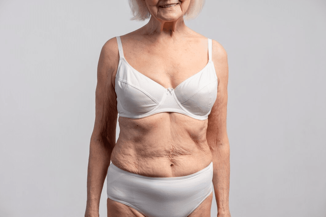 An elderly woman standing against a plain background, wearing a white bra and white underwear, showcasing her abdomen with visible wrinkles and skin folds.