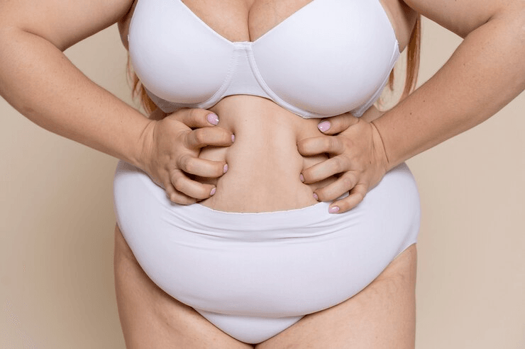 Сколько фунтов снимает липосакция? 2