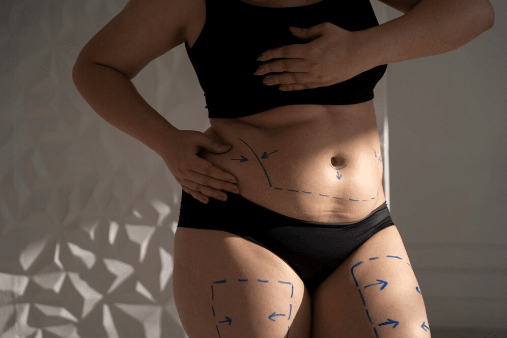 Ästhetische Chirurgie in Antalya: Ihr umfassender Leitfaden zur Verbesserung Ihrer Schönheit 4