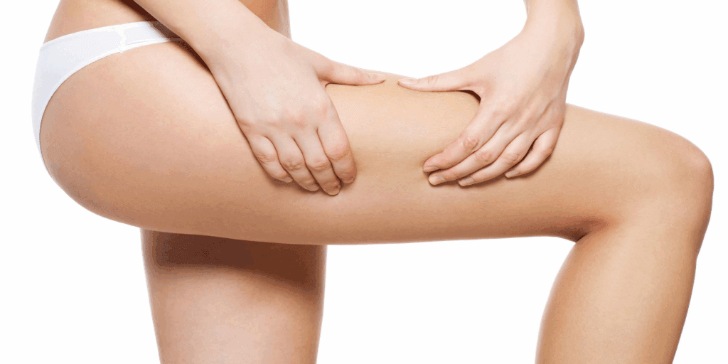 Thighplasty Surgery Cost & Insurance Coverage Guide 3