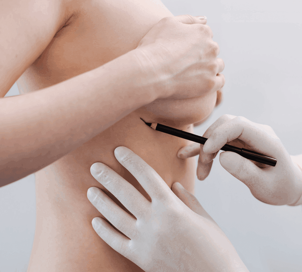 Breast Surgery Abroad: Types & How to Choose in 2025 2