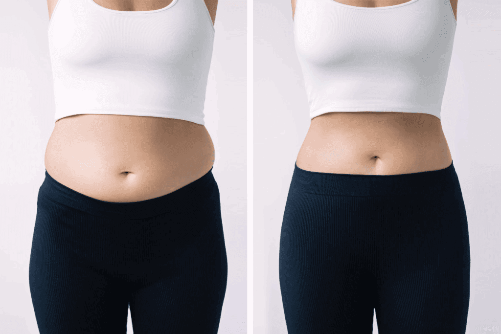 Cost of Body Contouring: Prices, Insurance, and Financing Guide 1