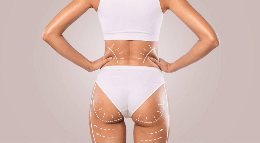 Cost of Body Contouring: Prices, Insurance, and Financing Guide 3
