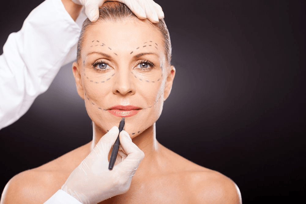 Key Factors to Consider Before Getting a Facelift Abroad 1