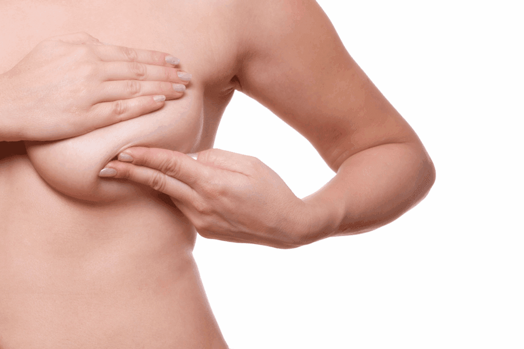 How Long Do Mastopexy Results Last? Can Sagging Reoccur? 2