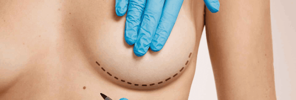 Breast Surgery Abroad: Risks, Complications & How to Minimize Them 2