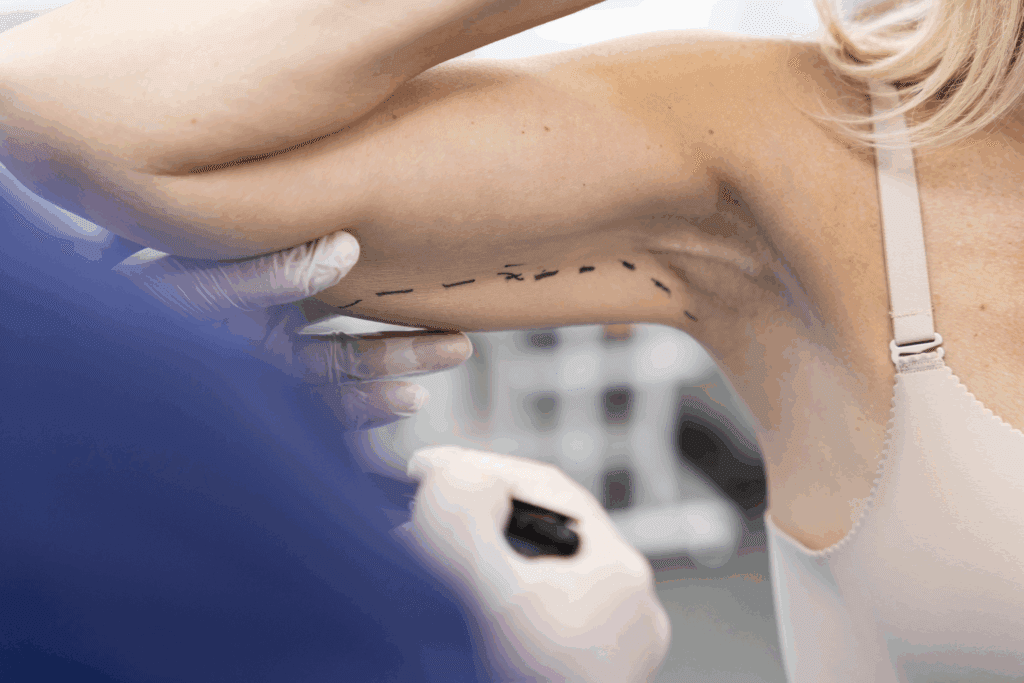 levantamiento de brazo