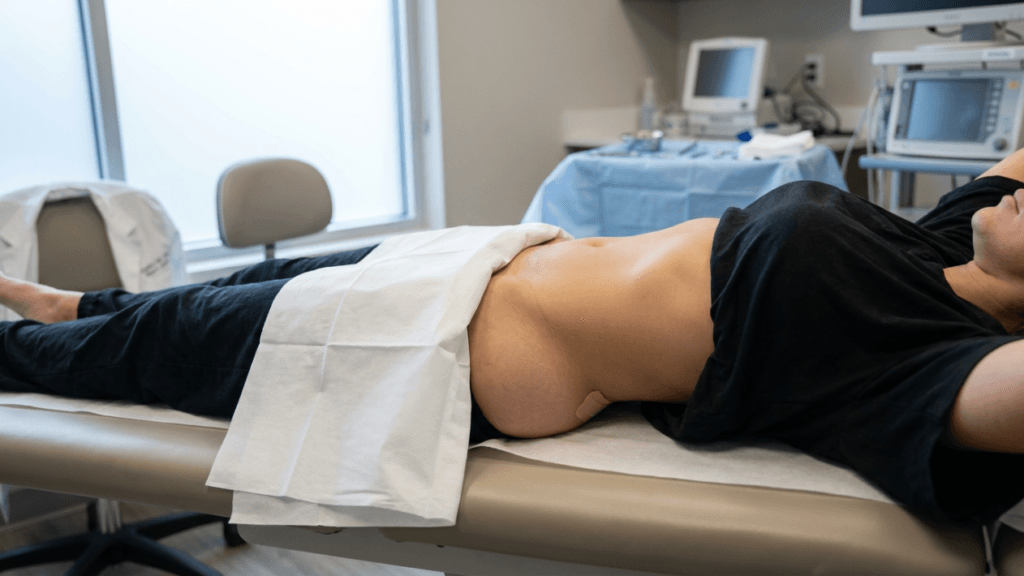 A side-profile view of a female patient lying on a medical examination table in a clinical office setting. The lighting is soft and natural, coming from a window on the left. The camera angle is at a mid-range, focus level to capture the patient's torso and abdomen, which is partially uncovered. The patient is wearing a black t-shirt and black pants, with a white medical drape placed across her lap. A small adhesive bandage is visible on her lower abdomen/hip area. The background features typical medical equipment, including a monitor and a tray with instruments, set against a neutral-colored wall. The patient is positioned with her arms raised behind her head.