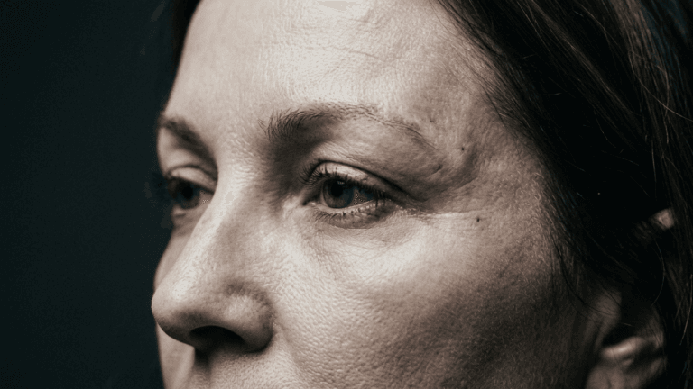 A close-up, side-profile portrait of a woman's face, captured with dramatic, low-key lighting that emphasizes skin texture and natural features. The camera angle is at eye level, focusing on the eye and temple area, where small, subtle surgical marks or incisions are visible near the eyebrow. The woman, identified as female, has a neutral expression, minimal to no makeup, and visible pores and fine lines, highlighting realistic facial anatomy. The background is a plain, dark, out-of-focus surface, ensuring the focus remains entirely on her face. Her hair is dark and partially visible on the sides of the frame.